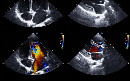 Cardiac Sonography image